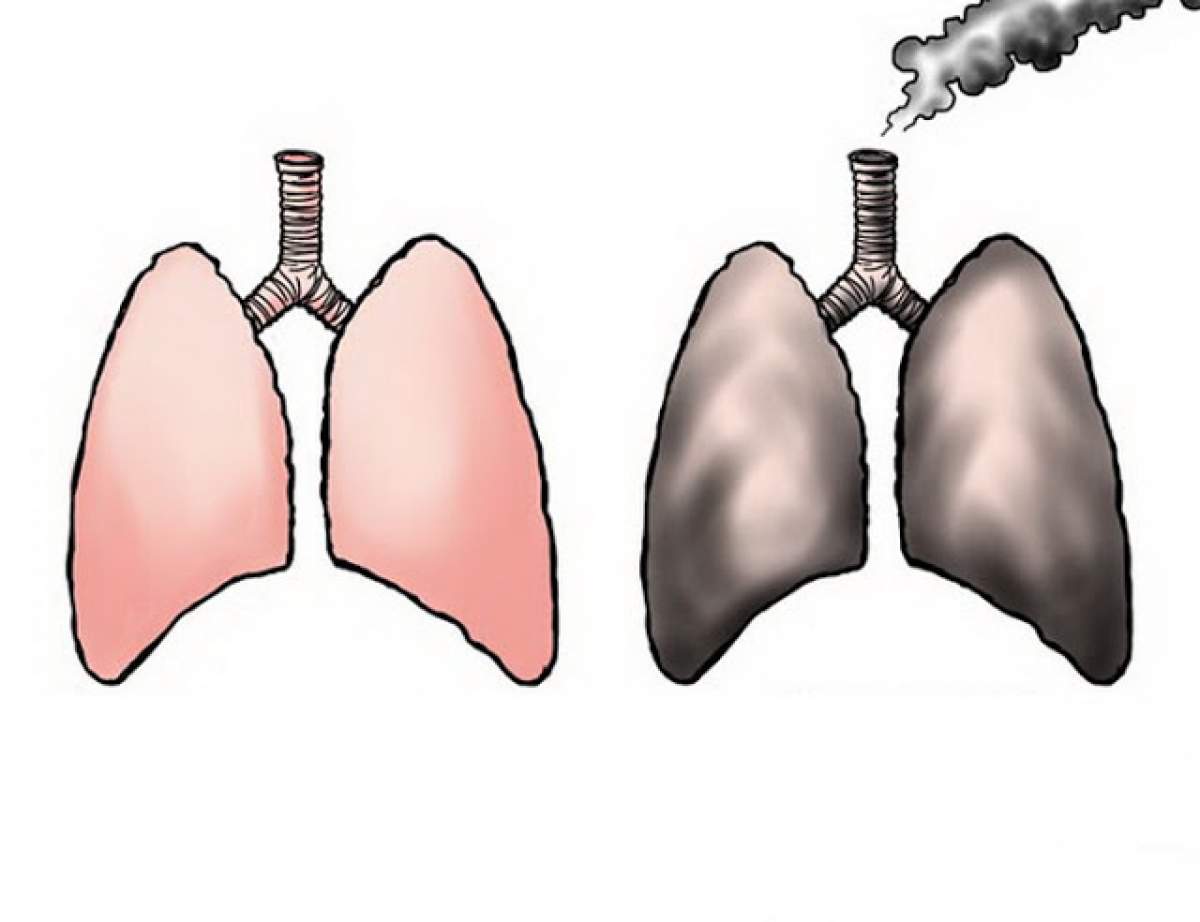Dacă fumezi de peste 5 ani încearcă această reţetă pentru curăţarea plămânilor! Rezultate spectaculoase în doar 30 de zile
