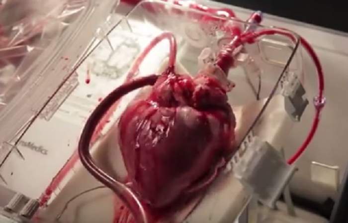 Imagini impresionante! Cum bate o inimă în afara corpului, înainte de a fi transplantată