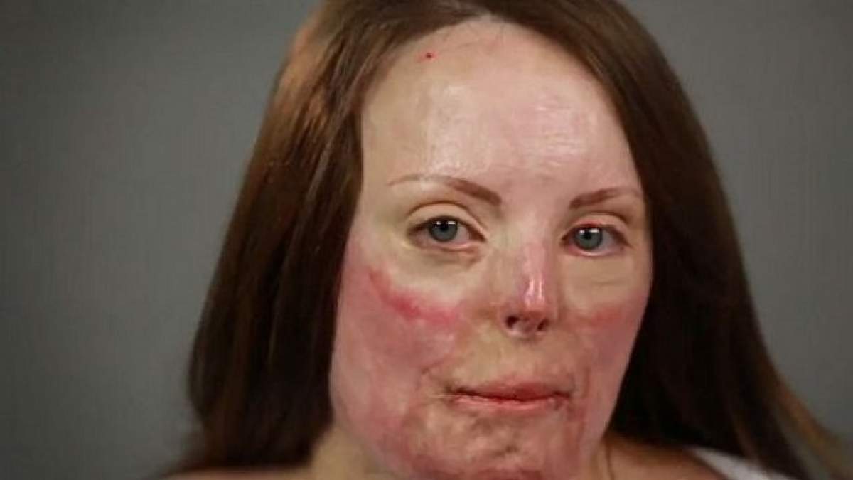 VIDEO / Transformare radicală! Cum arată o femeie cu arsuri pe 60% din suprafaţa pielii, după ce este machiată de un make-up artist