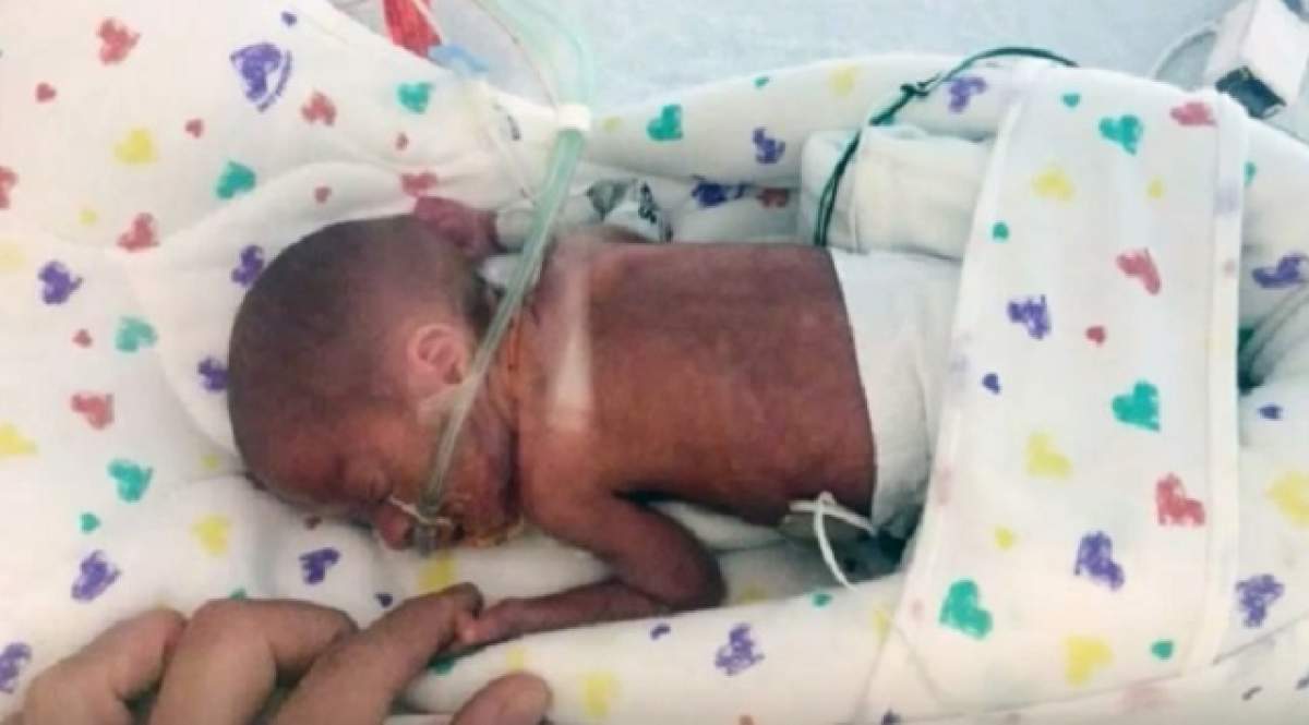 VIDEO / Caz de excepţie! Un bebeluş s-a născut cu patru luni mai devreme, în timp ce mama lui era într-o croazieră. Ce a urmat a uimit întreaga PLANETĂ