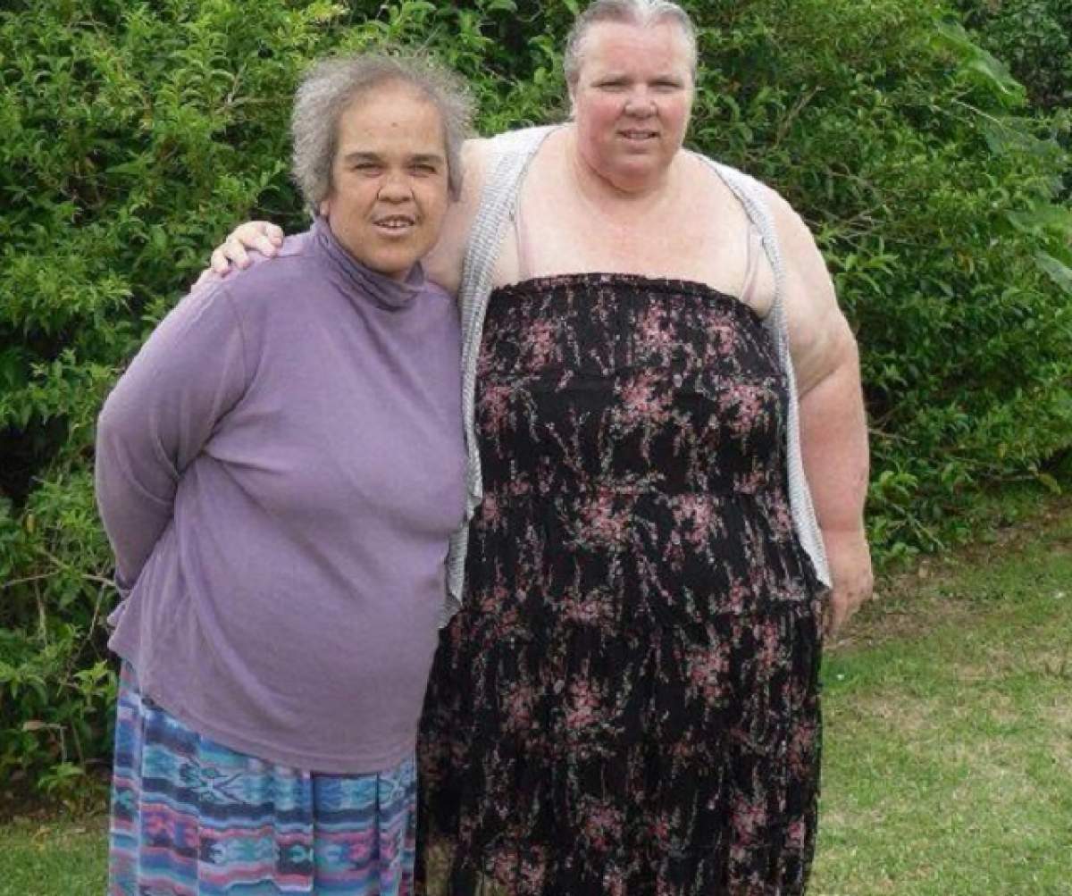 VIDEO / Ambiţie de fier, rezultate HORROR! Cum a ajuns să arate o femeie de 53 de ani, după ce a slăbit 112 kg. Atenţie! Imagini şocante!