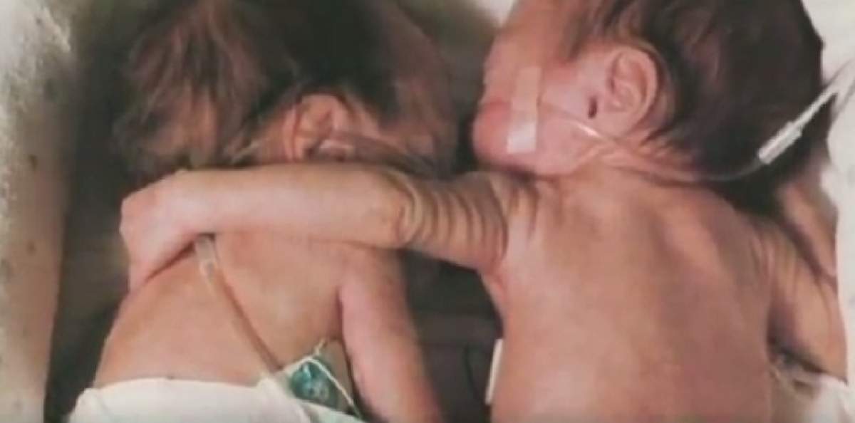 VIDEO / Puterea dragostei! Şi-a îmbrăţişat sora care era pe moarte, iar ce a urmat a impresionat o lume întreagă