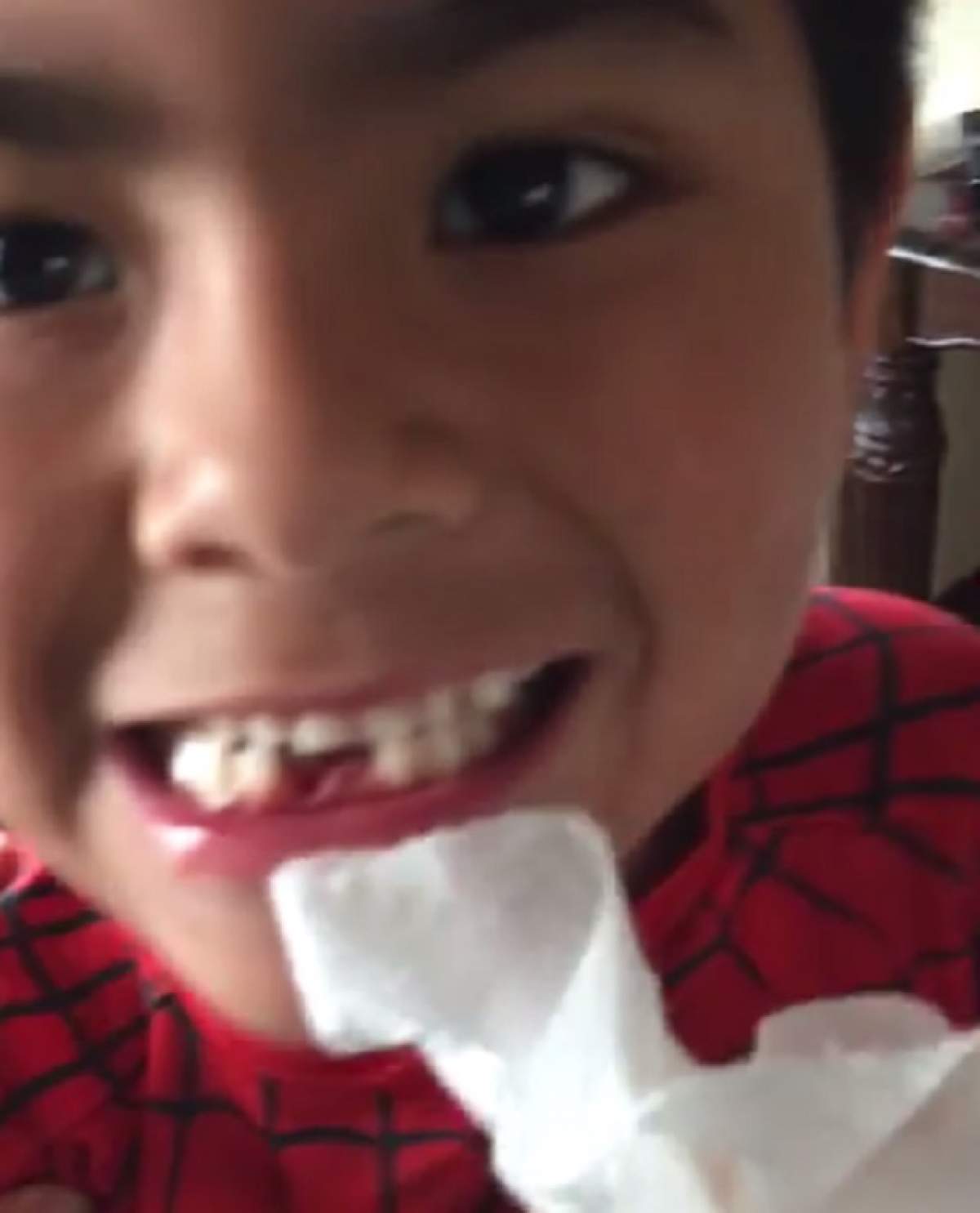 VIDEO / Şi-a zburat dintele din gură cu PISTOLUL! Curajul unui copil de ŞAPTE ANI
