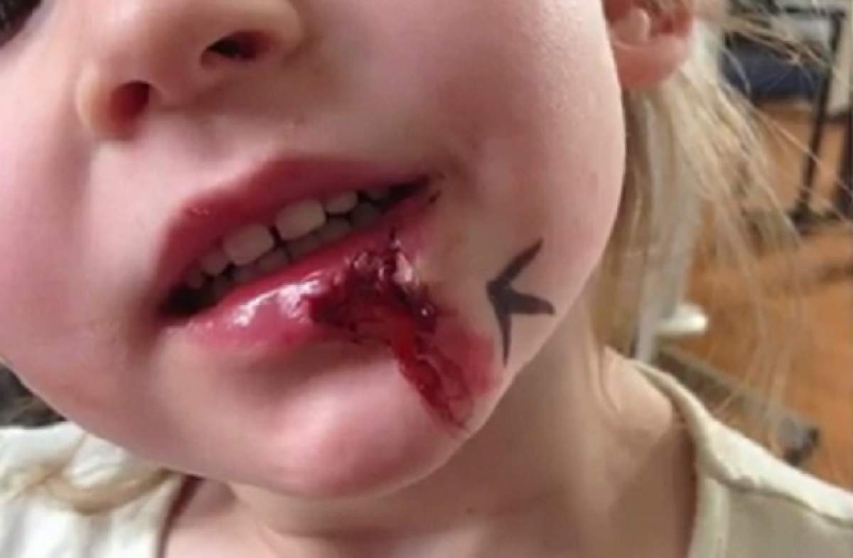 VIDEO / Ea e fetiţa bionică! Are 7 ani, nu mănâncă, nu doarme şi nu simte durerea -  nici atunci când e lovită de maşină