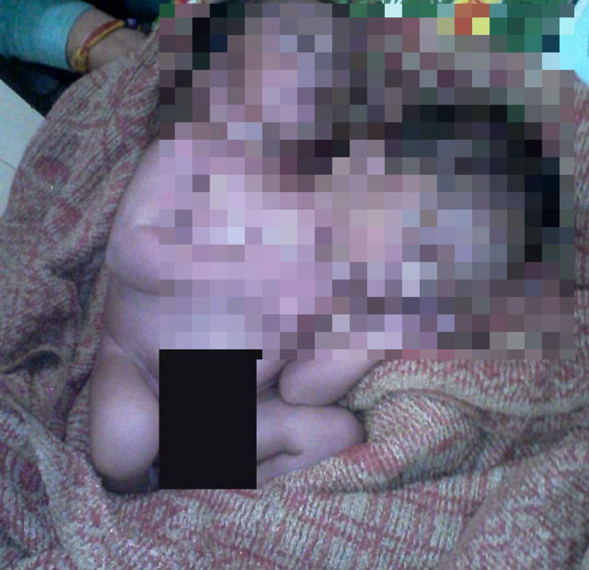 Caz tulburător în India! O femeie a născut un copil cu două capete: "Seamănă cu un extraterestru"