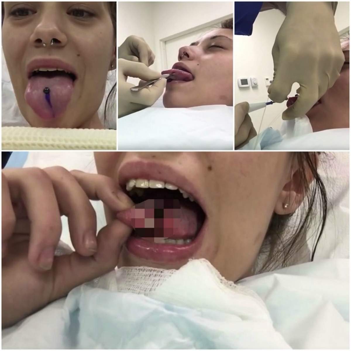 VIDEO / I-a marcat limba, după care a început să i-o cresteze! Imaginile care sperie mii de oameni