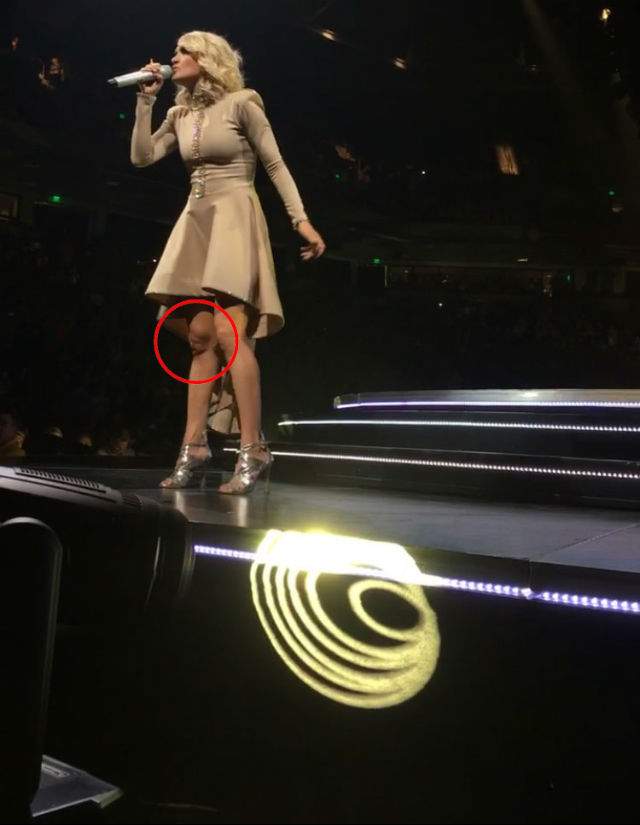 FOTO / Semn divin sau ce?!? Mulţi s-au închinat când au văzut ce a apărut pe genunchiul cântăreţei Carrie Underwood în timp ce susţinea un concert