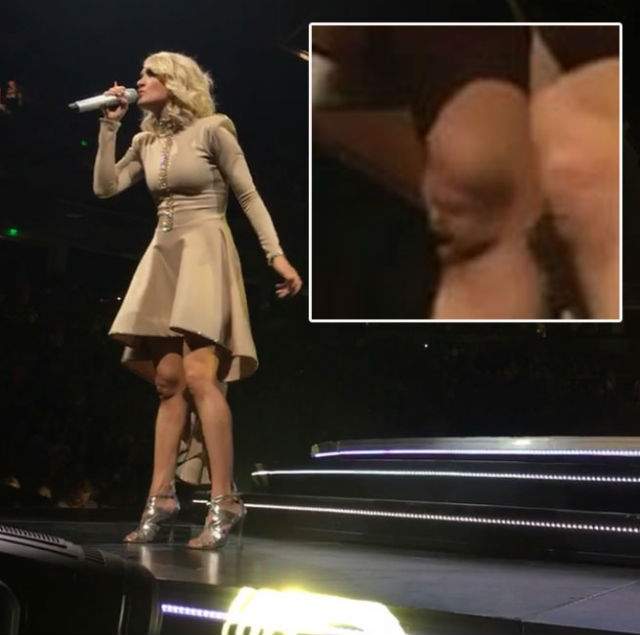 FOTO / Semn divin sau ce?!? Mulţi s-au închinat când au văzut ce a apărut pe genunchiul cântăreţei Carrie Underwood în timp ce susţinea un concert