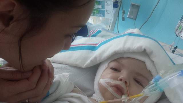 FOTO / Siamezi, separaţi după o operaţie craniană maraton ce a durat 20 de ore. Imagini impresionante cu cei doi copilaşi , la scurt timp după intervenţie
