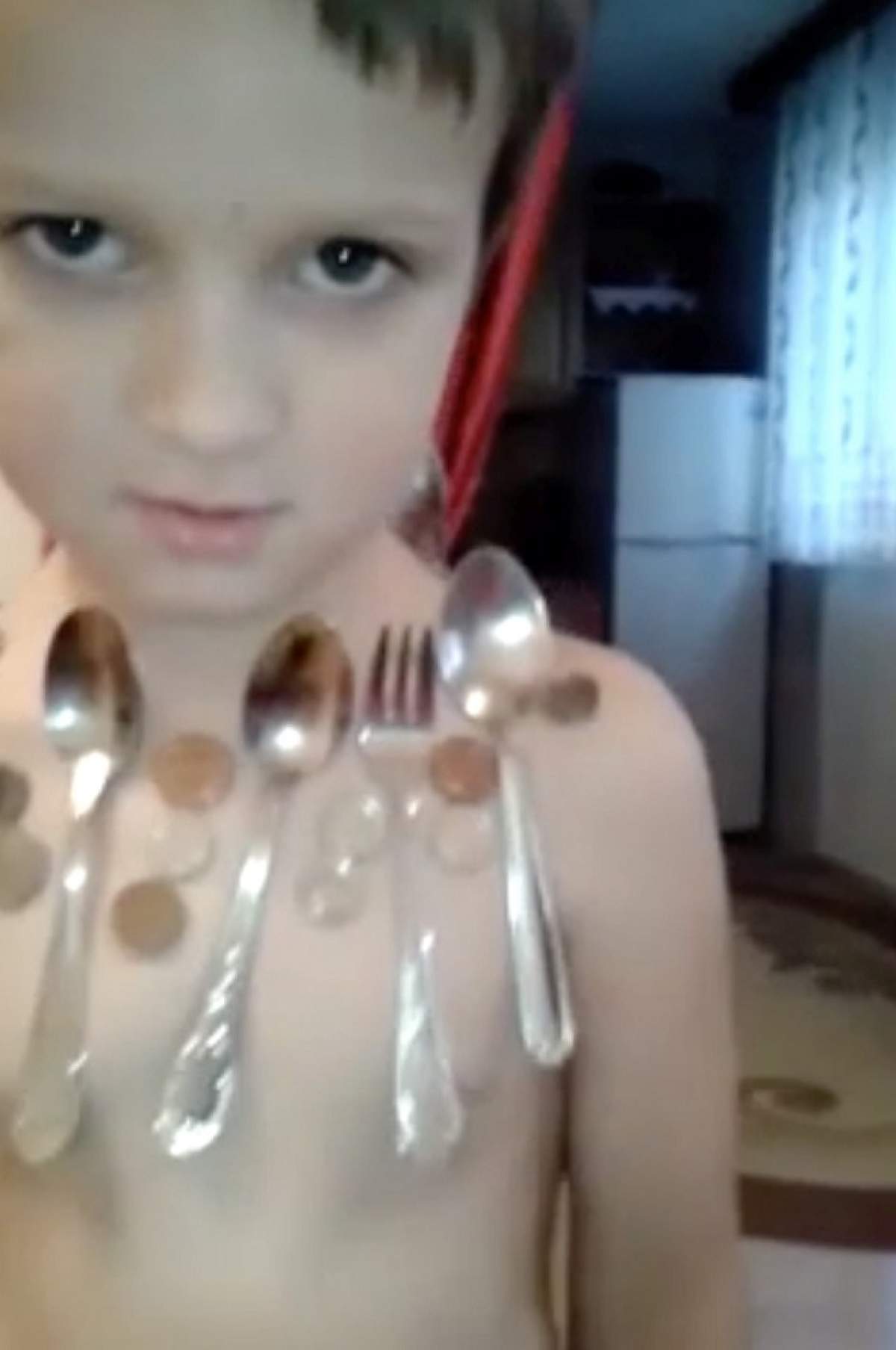 VIDEO / Ce pui pe el se lipeşte! Un băieţel de 5 ani a fost depistat cu un fenomen bizar în faţa căruia medicii au amuţit