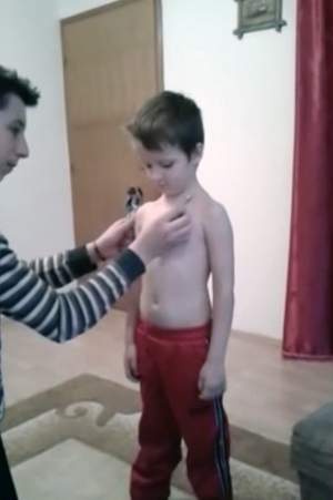 VIDEO / Ce pui pe el se lipeşte! Un băieţel de 5 ani a fost depistat cu un fenomen bizar în faţa căruia medicii au amuţit