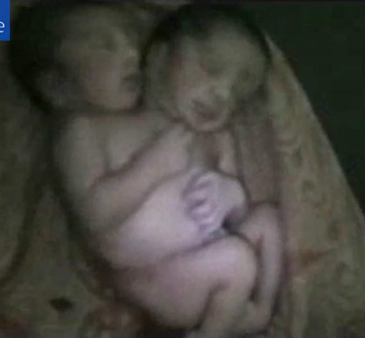 VIDEO / Bebeluş cu DOUĂ CAPETE a fost numit un miracol, dar ce s-a întâmplat la doar 32 de ore este tragic!