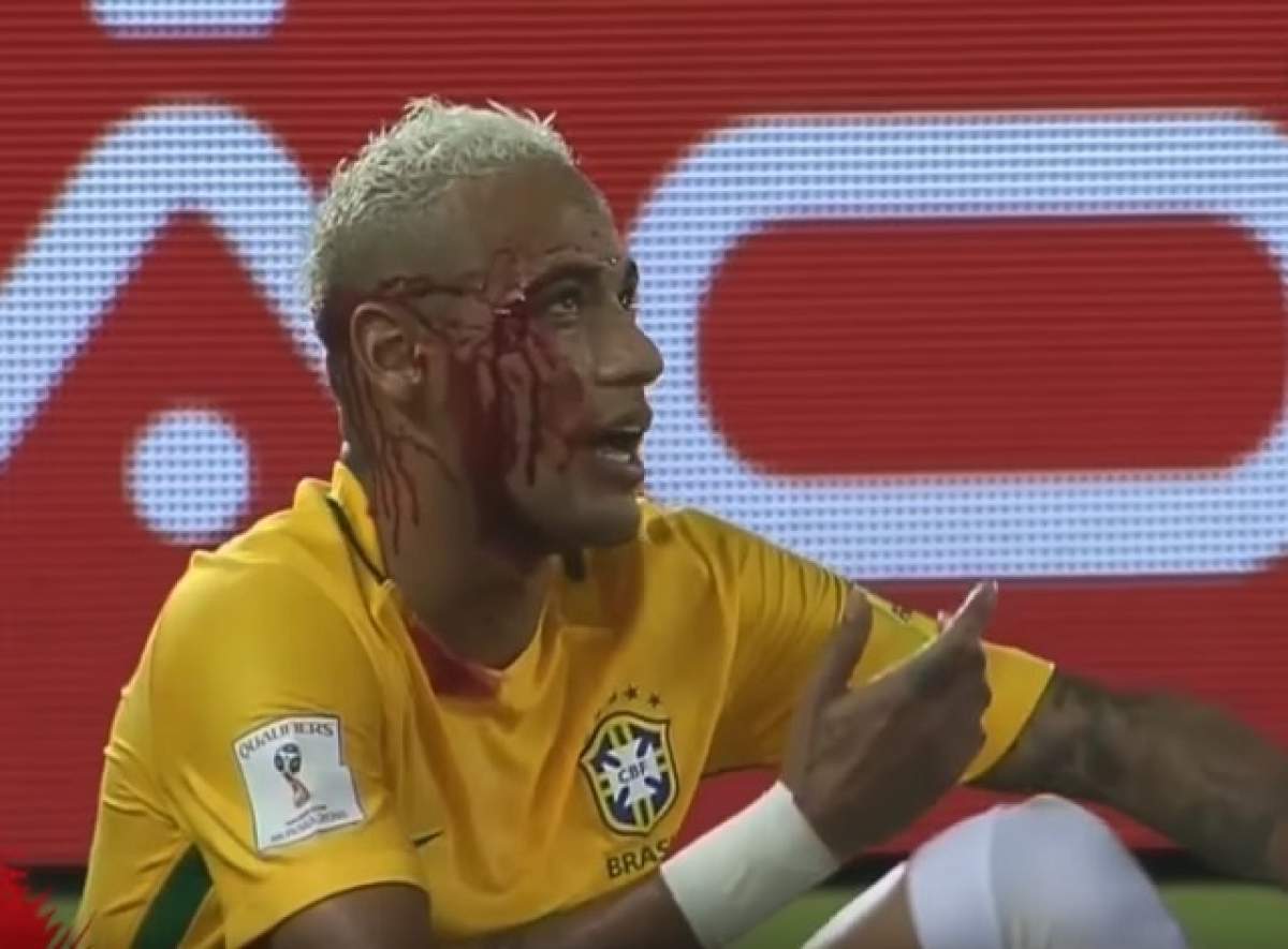 VIDEO HORROR / Neymar, umplut de sânge după ce a încercat să-şi ridiculizeze un adversar!
