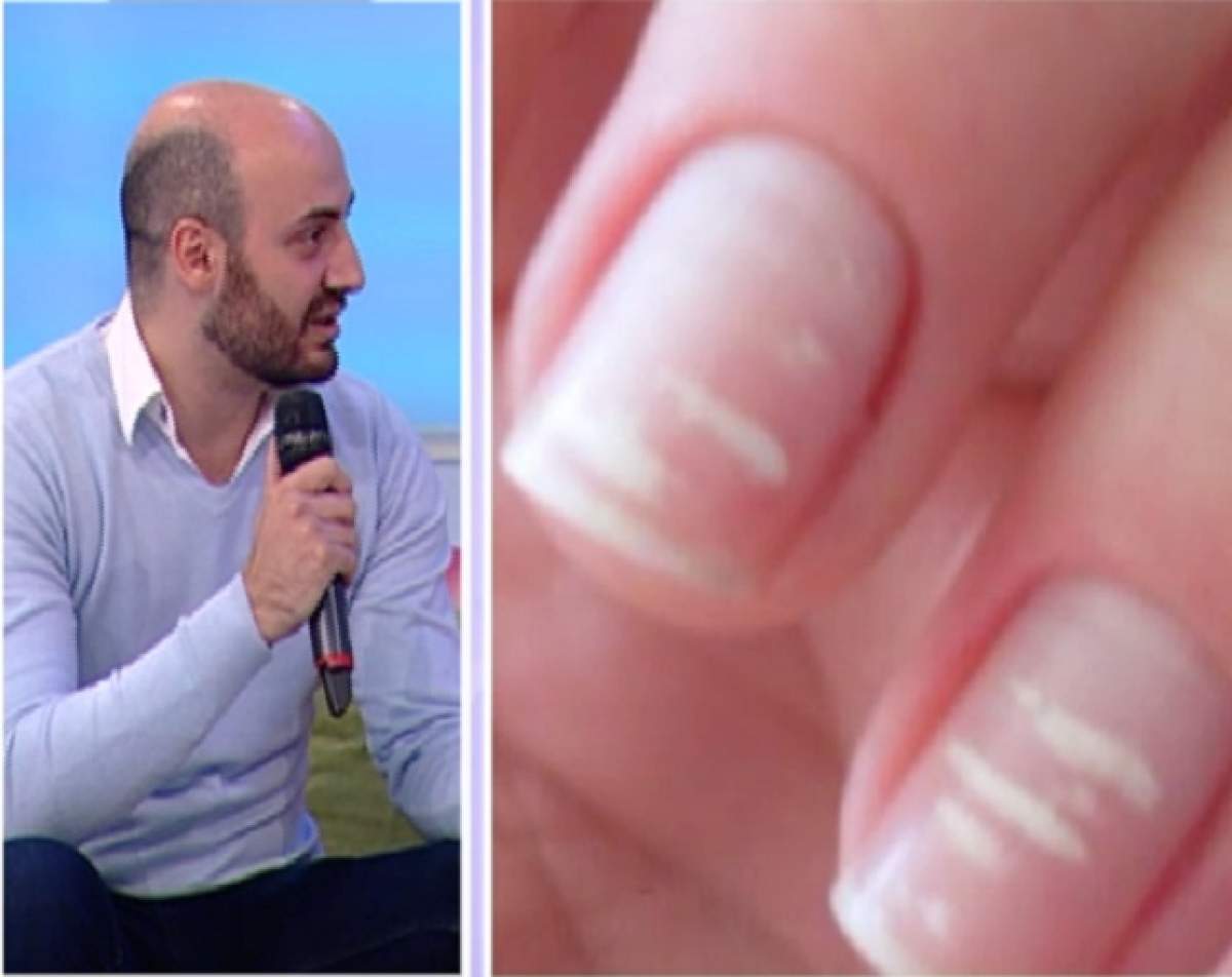 VIDEO / Ce boli ascund unghiile tale? Specialiştii avertizează!