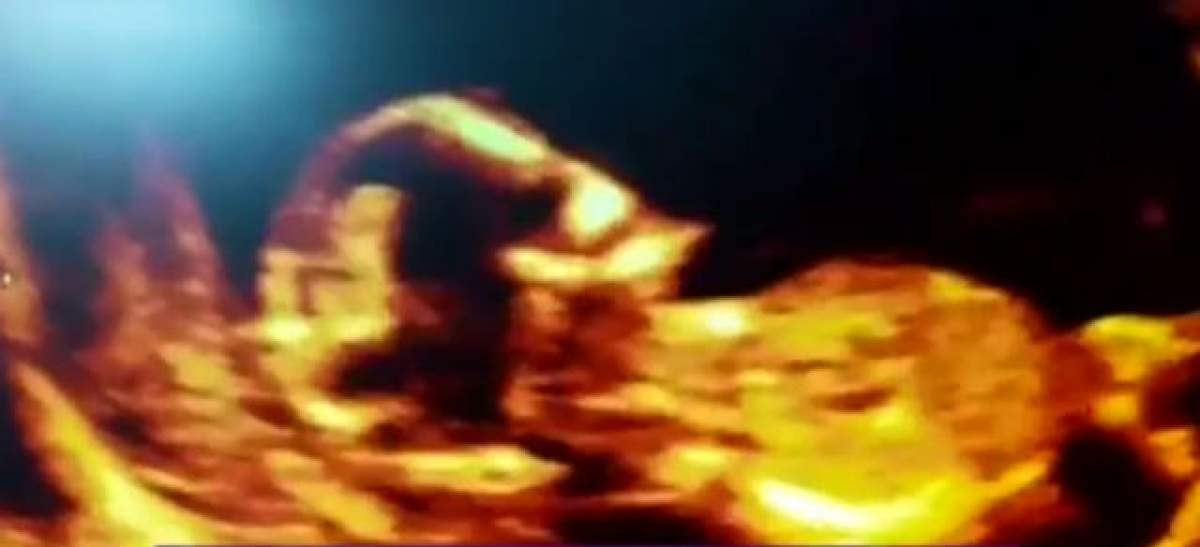 VIDEO / Sarcina Danei Roba, presărată de greutăţi! Imagini emoţionante cu gesturile micuţei Chantal