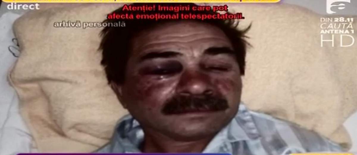 VIDEO / Imagini şocante! Un bărbat din Timişoara, legat de calorifer cu cătuşele şi bătut groaznic