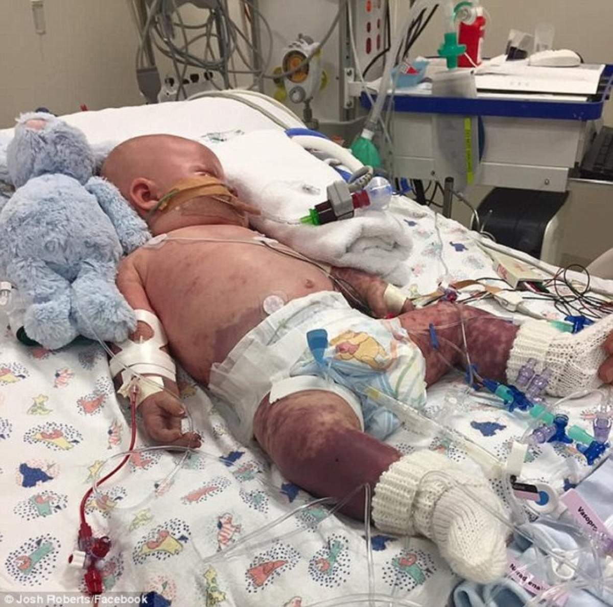 A ajuns la medic de urgenţă şi a fost diagnosticat cu infecţie la ureche. Ce avea, de fapt, copilul. Acum se zbate între viaţă şi moarte