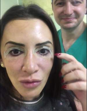 VIDEO / Mara Bănică, din nou pe mâna esteticienilor! Aşa arată vedeta acum: "Două ore şi jumătate în sala de operaţii"