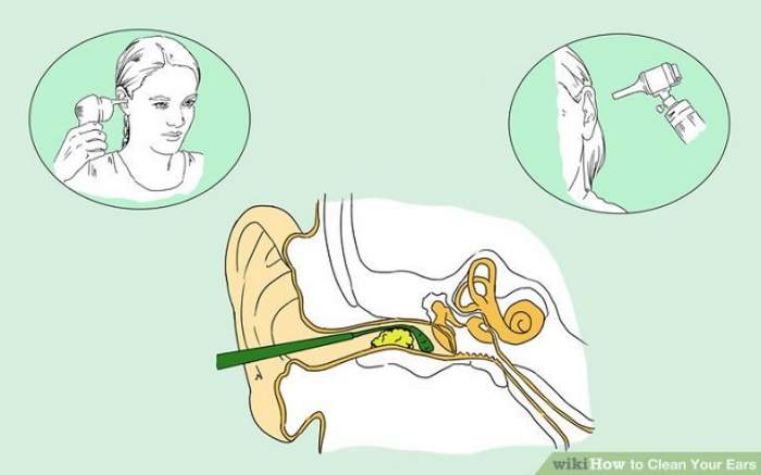Как почистить уши дома