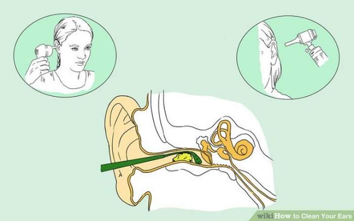Как чистить уши. Мытье ушей. Чистка ушей.. Как правильно почистить уши. Как почистить уши внутри.