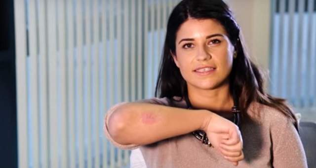 FOTO / Se luptă cu psoriazisul, a trecut prin chinuri groaznice, iar acum face un anunț bombă: e însărcinată!