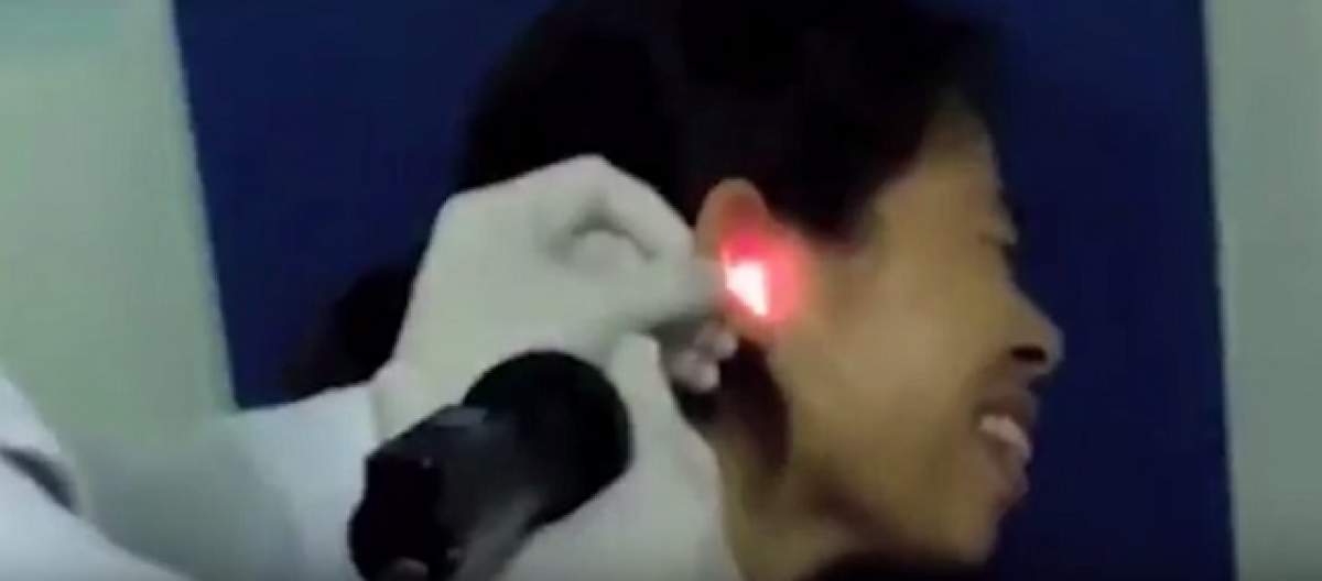 VIDEO / Ce scârbos! Asta a reuşit să scoată un doctor din urechea unei paciente