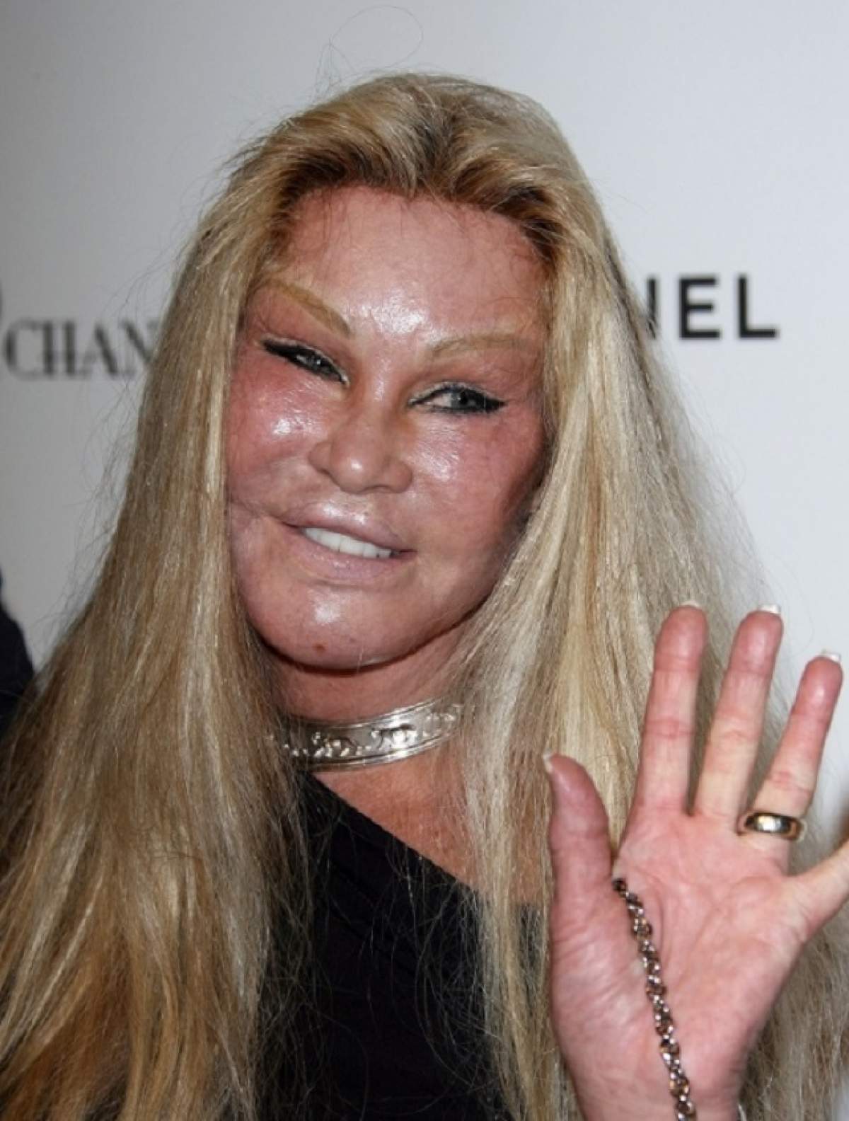 "Femeia pisică" a fost arestată! Jocelyn Wildenstein şi-a tăiat iubitul cu o foarfecă