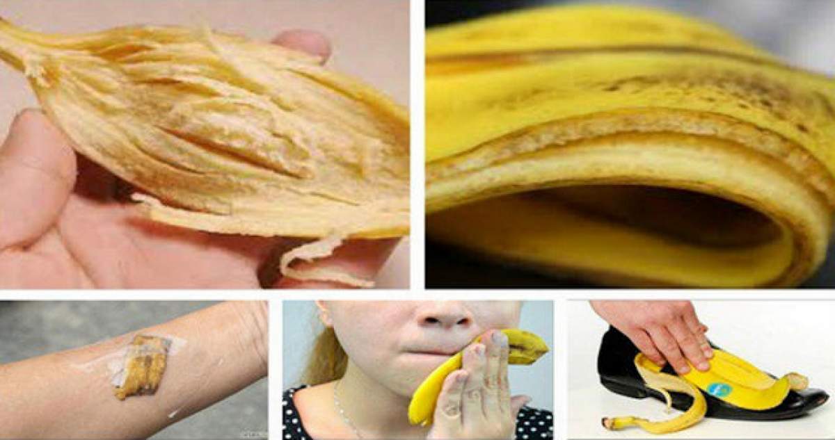 După ce vei citi asta, nu vei mai arunca niciodată la gunoi cojile de banane! Este incredibil câte lucruri utile poţi face cu ele