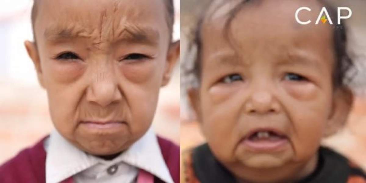 VIDEO / Are doar şapte ani, dar arată de 80! Imagini cutremurătoare cu boala care transformă copiii în bătrâni