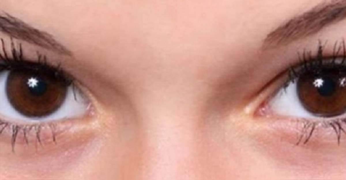 Ai cercuri negre sub ochi? Vizita la doctor trebuie neapărat făcută! Eşti în pericol