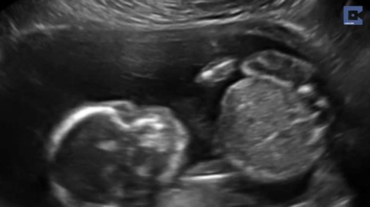 VIDEO / O gravidă a mers să-şi facă ecografia uzuală! Medicii şi viitoarea mămică au rămas fără cuvinte când au văzut ce făcea fătul în pântec