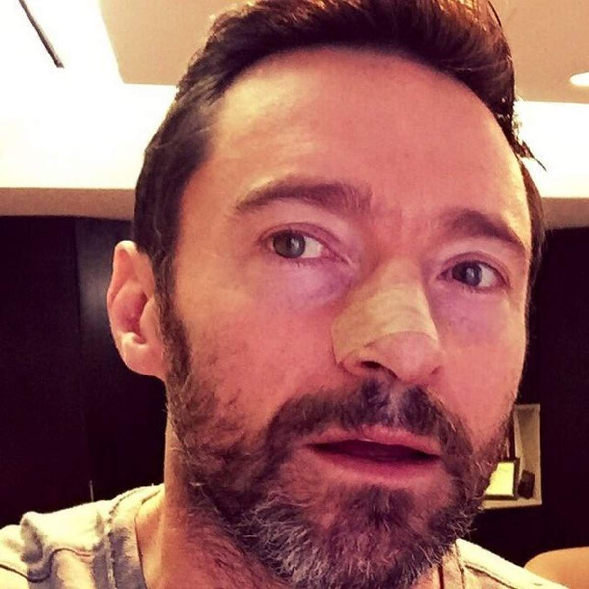 Hugh Jackman le dă un sfat vital fanilor săi, după ce a învins din nou cancerul. Toată lumea ar trebui să ia aminte