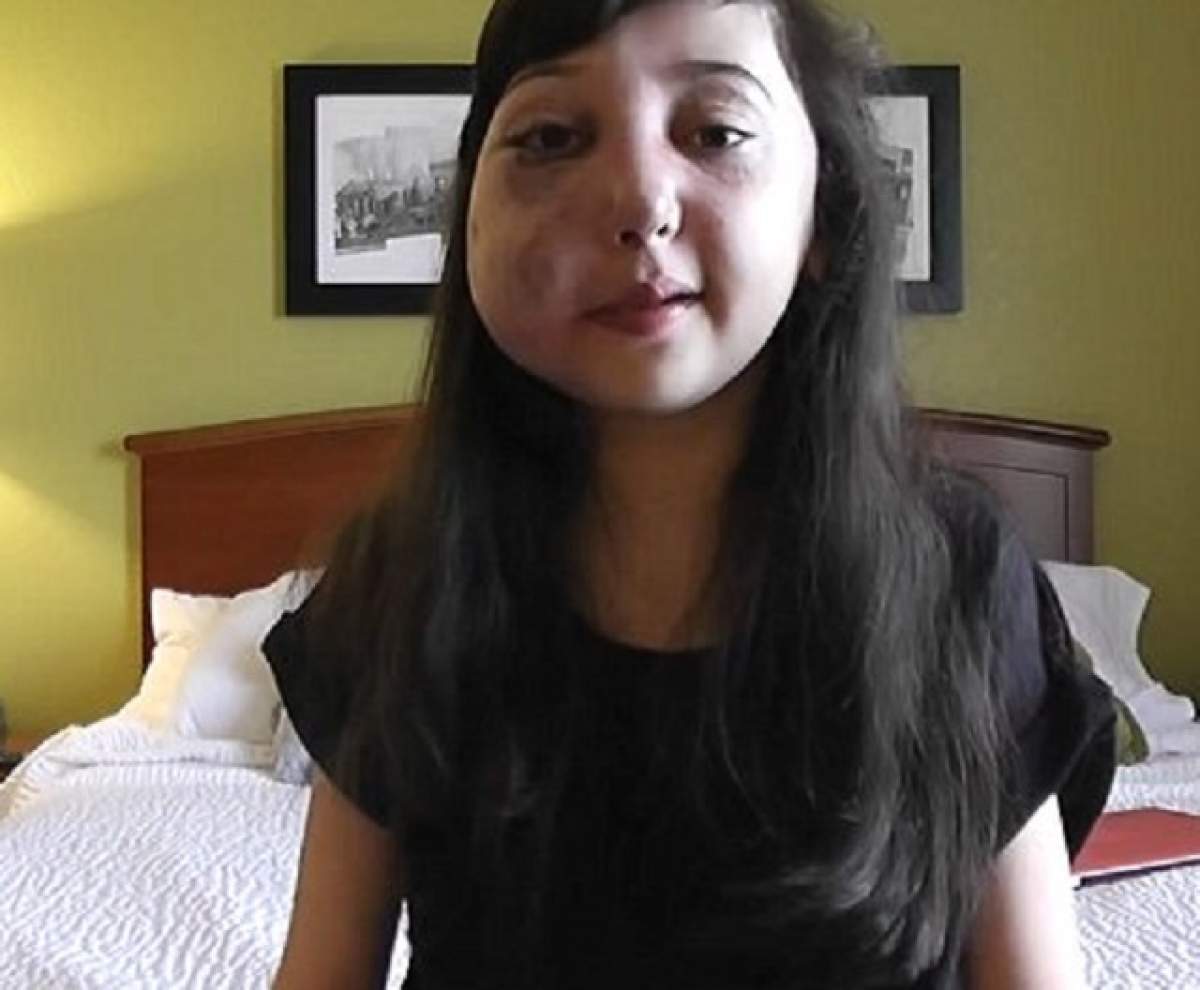 VIDEO / Are faţa desfigurată, dar a devenit vedetă pe internet! Adolescenta de 11 ani oferă sfaturi de frumuseţe