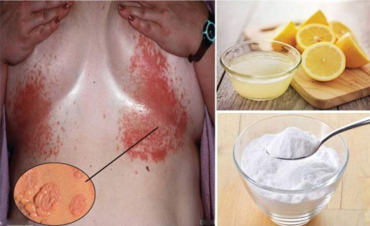Pune câteva picături de suc de lămâie în cadă înainte să faci baie! Uite cum s-o faci ca să scapi definitiv de iritarea de sub sâni