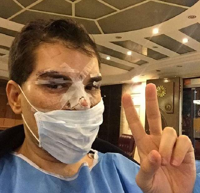 VIDEO / A cheltuit 384.000 de euro ca să se transforme în Ken, dar una dintre operaţii l-a băgat în spital! Rodrigo Alves: "Infecţia poate să-mi cuprindă toată faţa"