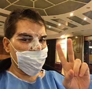 VIDEO / A cheltuit 384.000 de euro ca să se transforme în Ken, dar una dintre operaţii l-a băgat în spital! Rodrigo Alves: "Infecţia poate să-mi cuprindă toată faţa"