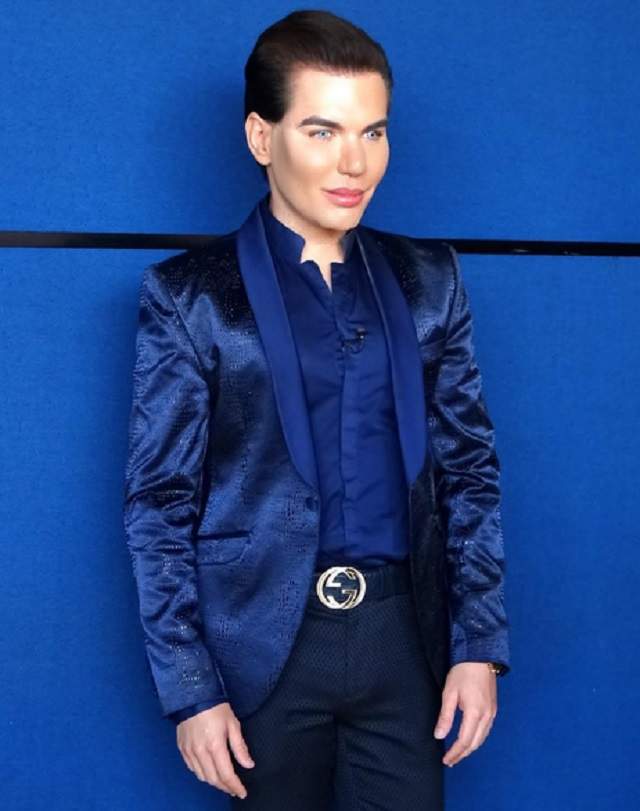 VIDEO / A cheltuit 384.000 de euro ca să se transforme în Ken, dar una dintre operaţii l-a băgat în spital! Rodrigo Alves: "Infecţia poate să-mi cuprindă toată faţa"