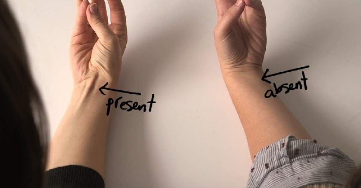 Ai un tendon proeminent lângă încheietura mâinii? Descoperă ce spune acesta despre tine