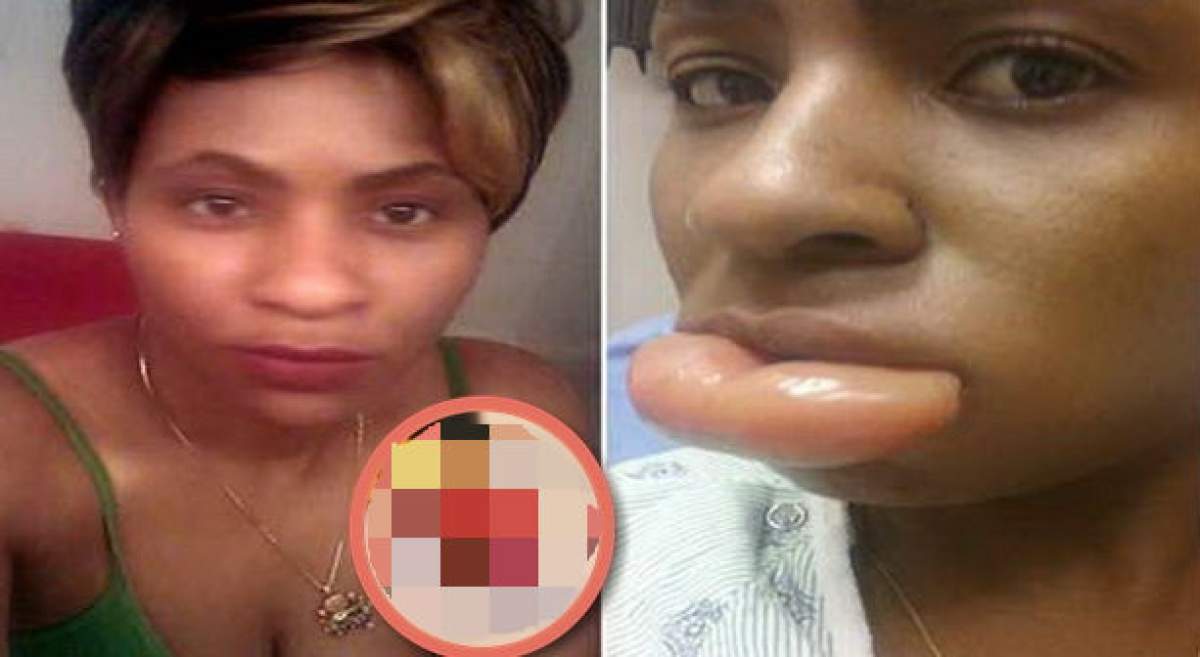 La un pas de moarte din cauza machiajului. Şi-a cumpărat produse cosmetice şi a rămas cu buza umflată, la propriu!