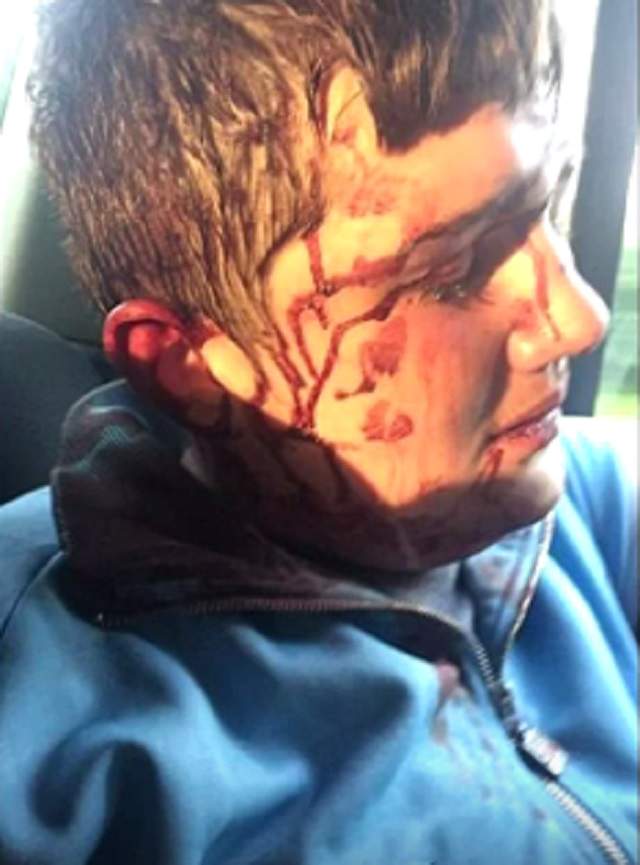 VIDEO / Imagini şocante! Un elev a fost bătut de 8 bărbaţi cu răngi şi ciocane