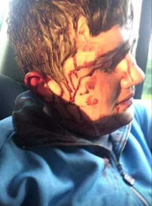 VIDEO / Imagini şocante! Un elev a fost bătut de 8 bărbaţi cu răngi şi ciocane