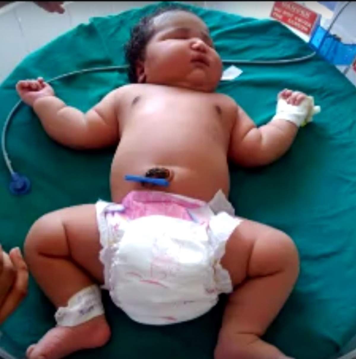 VIDEO / A adus pe lume un bebeluş gigant şi a şocat medicii: "Am 25 de ani de experienţă, dar nu am văzut niciodată aşa ceva!"