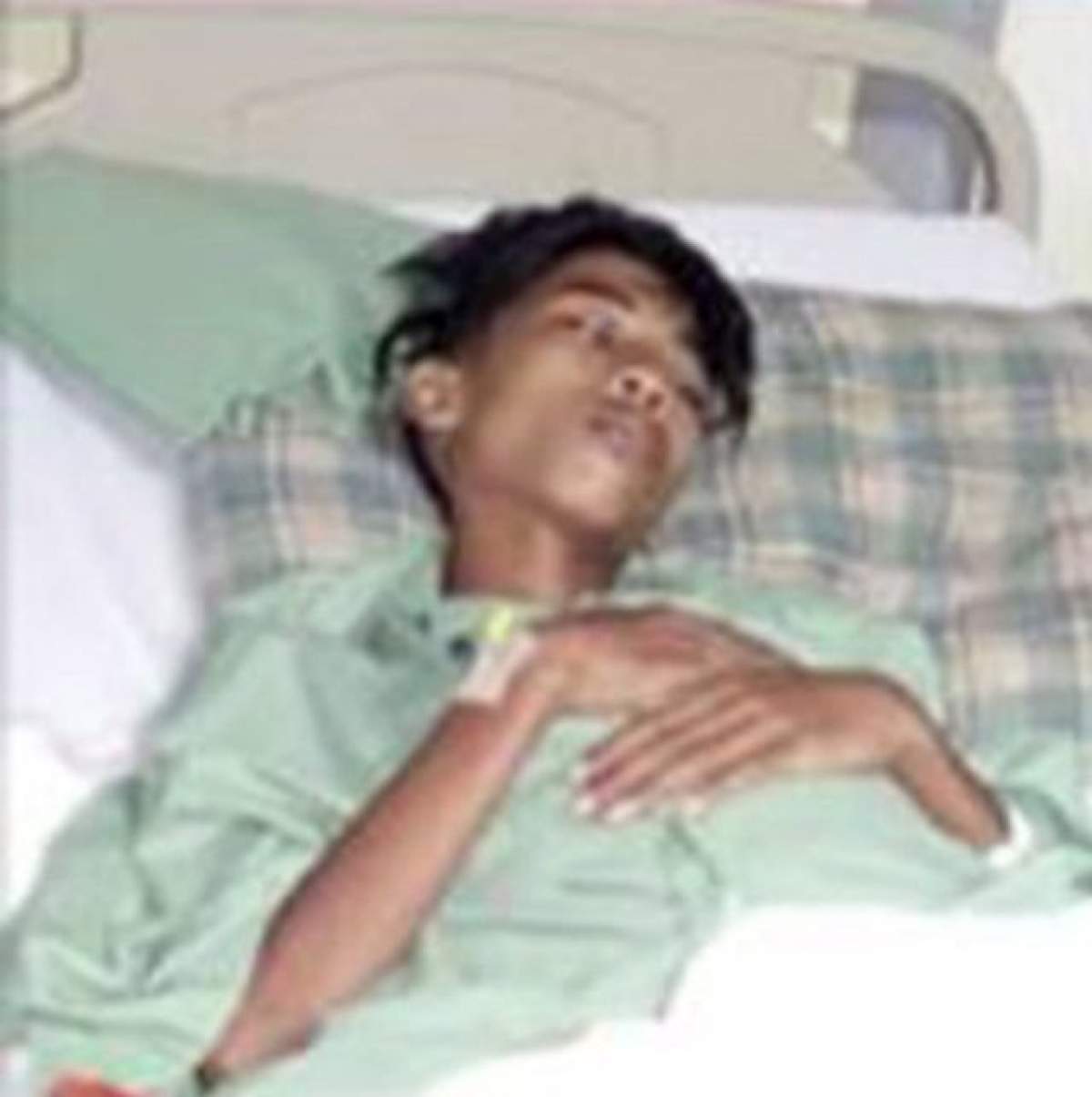 VIDEO / A stat lipit de fratele său geamăn timp de 15 ani, iar medicii au intervenit de urgență și au descoperit o imagine șocantă