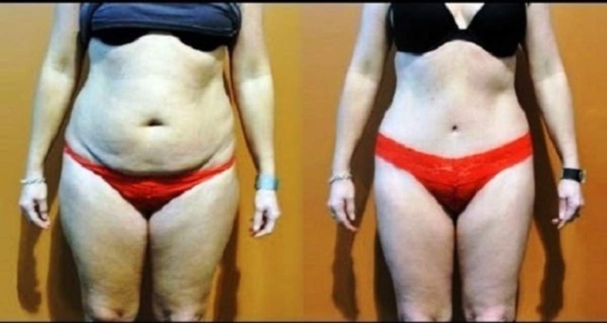 Dieta fulger care dă jos de pe tine 15 kilograme în două săptămâni!