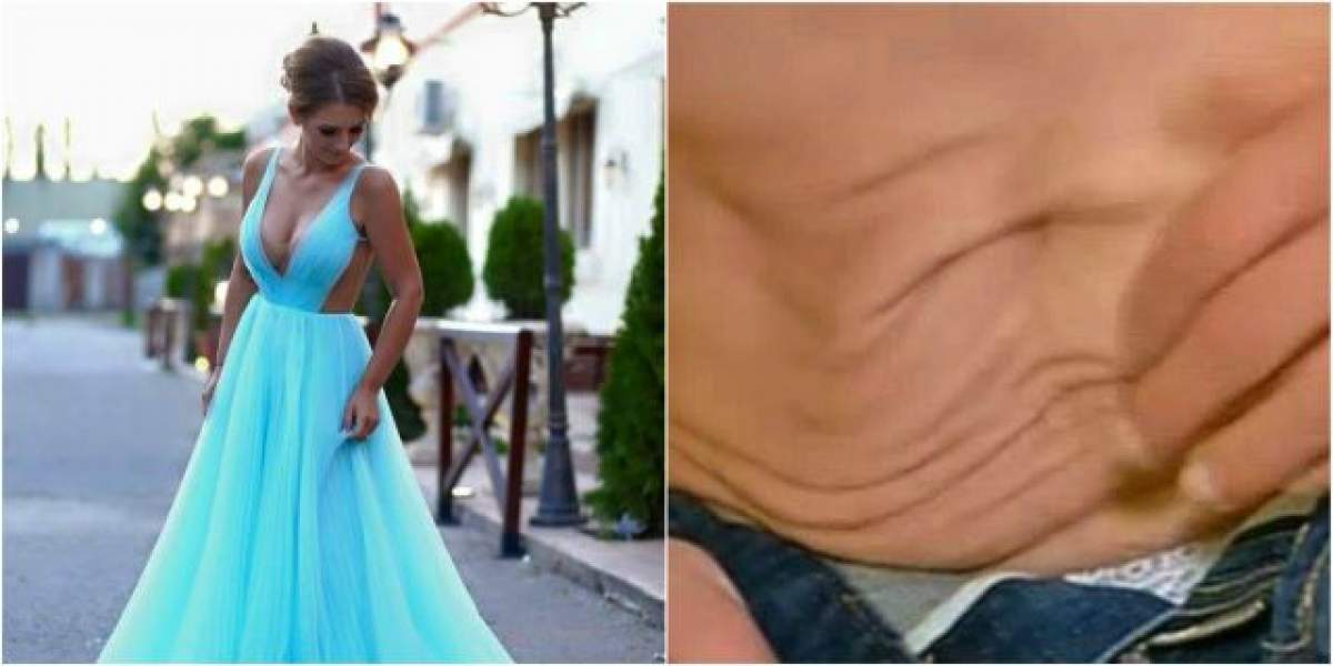 Îmbrăcată arată perfect, dar când scapă de haine e DEZASTRU! Adina Bourceanu a arătat adevărata faţă a slăbirii: "Am dat jos 35 de kg în 10 luni"