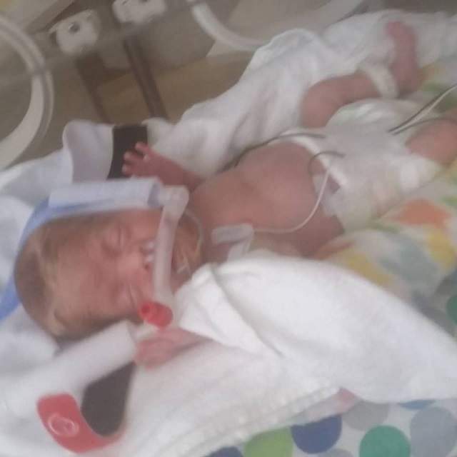 FOTO / Un bebeluş s-a născut  la 25 de săptămâni şi a fost pus la incubator într-o pungă! Acum a fost externat din spital. Cum arată copilul