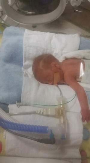 FOTO / Un bebeluş s-a născut  la 25 de săptămâni şi a fost pus la incubator într-o pungă! Acum a fost externat din spital. Cum arată copilul