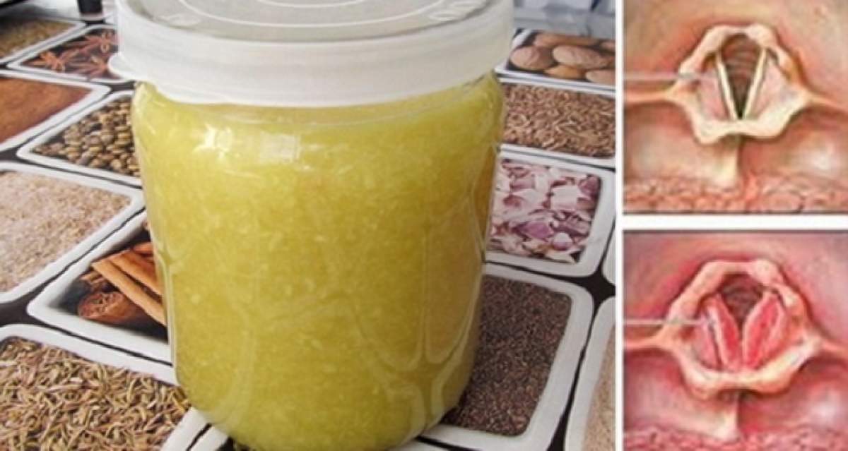 E mai simplu decât crezi! Cum scapi de răguşeală cu ajutorul unui remediu natural, preparat în casă