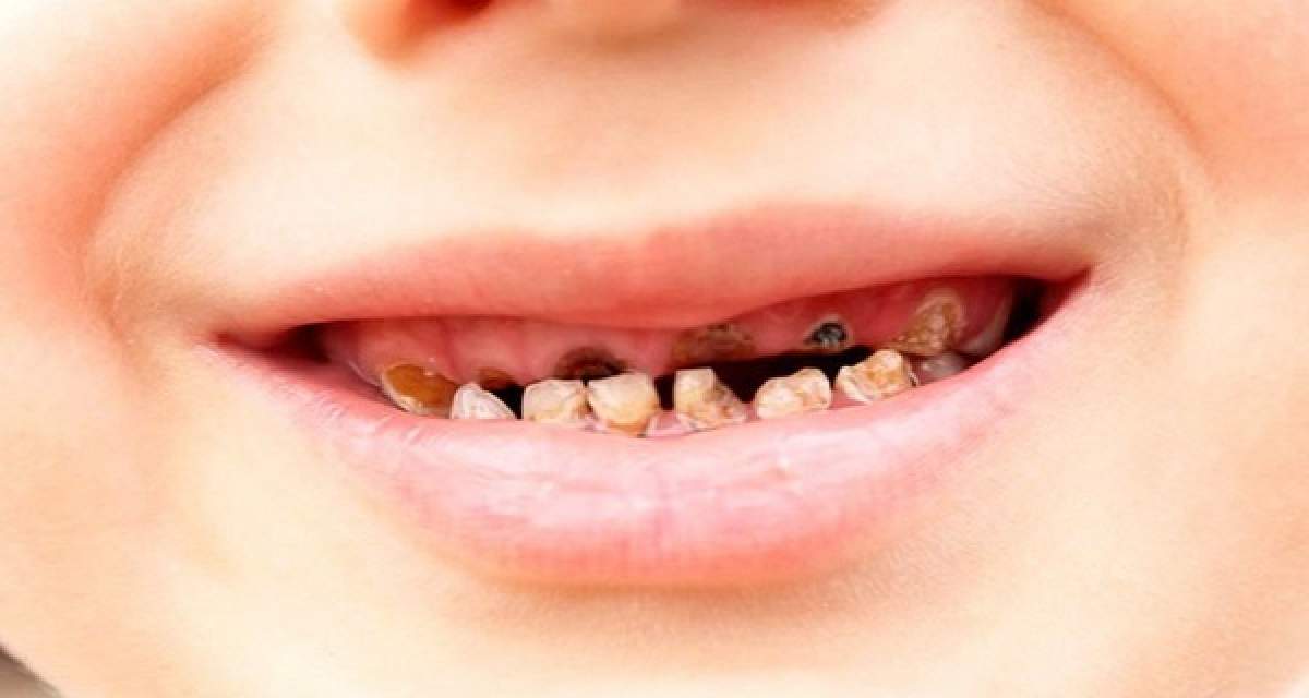 ÎNTREBAREA ZILEI: Joi- Ce se întâmplă dacă un copil consumă prea multe băuturi carbogazoase?