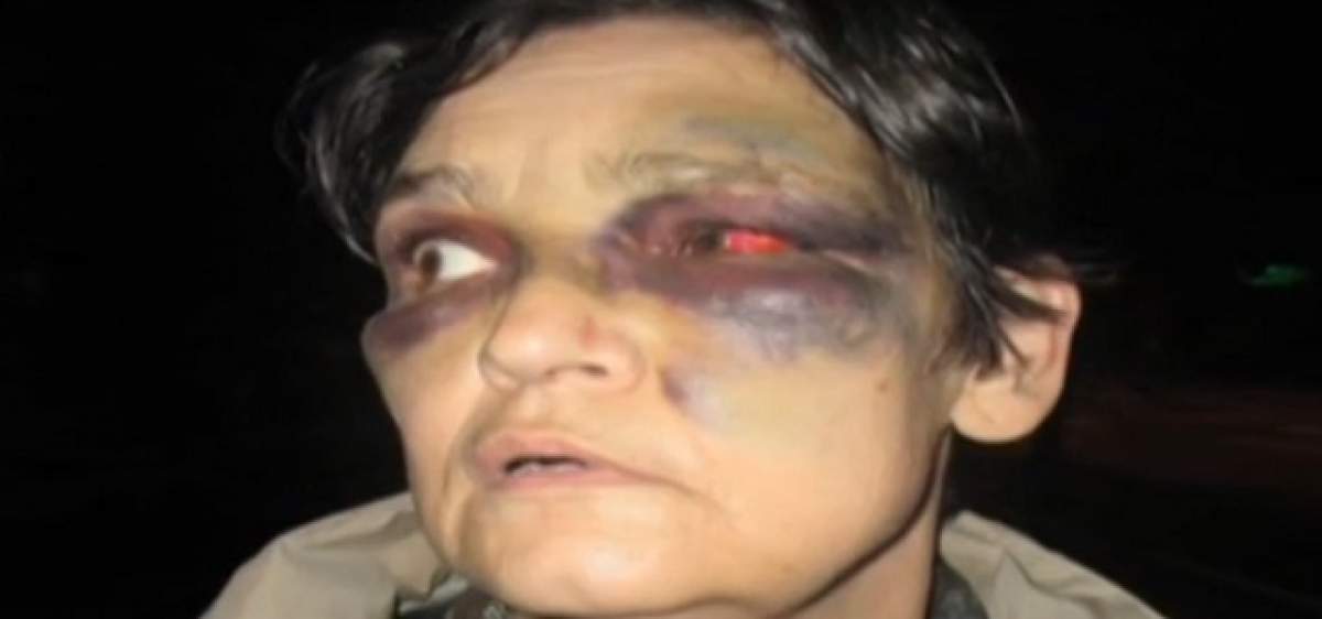 VIDEO / Snopită de propriul copil! O femeie a fost desfigurată de fiul de 19 ani! Imagini sfâşietoare